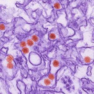 This is a digitally-colorized transmission electron micrographn of Zika virus. Virus particles are colored red. Image by Cynthia Goldsmith/Centers for Disease Control and Prevention.