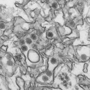 Transmission electron micrograph of Zika virus. (Photo: Cynthia Goldsmith, Centers for Disease Control and Prevention)