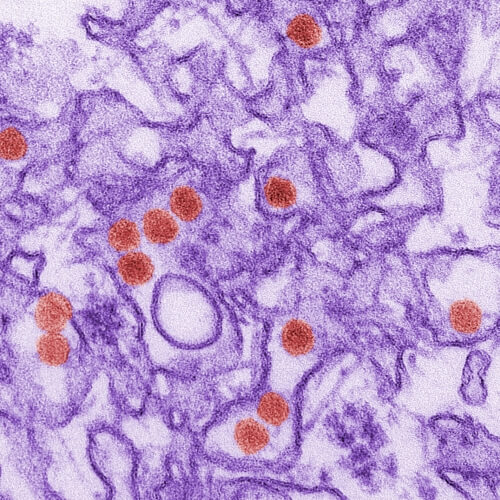 Zika-colorized-red-500x500