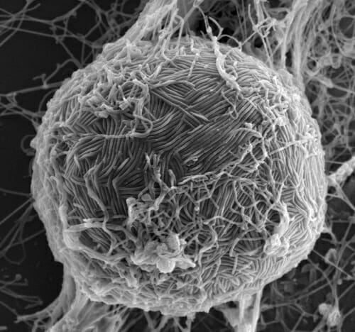 Ebola vaccine inches toward human clinical trials