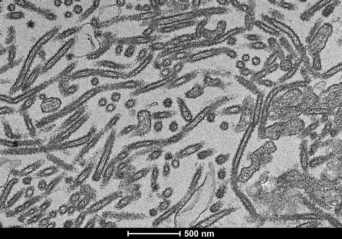 H3N2 viruses mutate during vaccine production but new tech could fix it