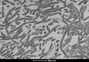 H3N2 viruses mutate during vaccine production but new tech could fix it