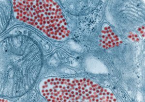 Equine encephalitis detection highlights need to protect horses, people