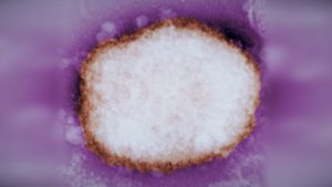 From STAT: U.S. monkeypox case reported, as Spain, Portugal report infections in growing outbreak